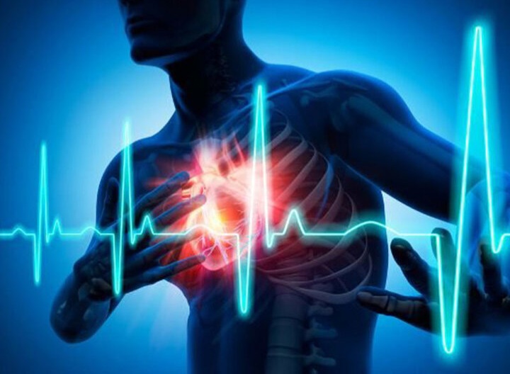 فیبریلاسیون دهلیزی درمان نشده خطر کاهش حافظه را افزایش می دهد