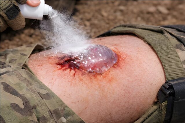 توقف یک ثانیه‌ای خونریزی ممکن شد